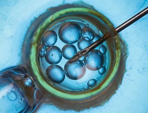 美国试管婴儿前要准备什么